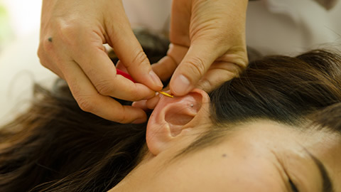 全身治療+美容鍼(電気なし)