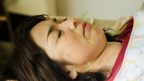 全身治療+美容鍼(電気なし)